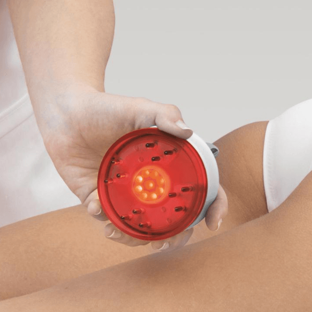 Soin du corps, vergetures avec So Up